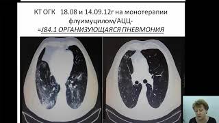 Особенности течения и реабилитации больных с патологией лёгких в постковидном периоде.