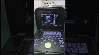 B/W mode Ultrasound Scanner