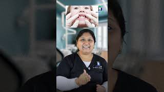 யாருக்கு ஃப்ளூரைடு இல்லாத பேஸ்ட்? Who should use fluoride free toothpaste? | Dr.Aparna | Denta Kings