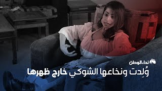 المجتمع همّشني بسبب رجلي القصيرة... فقلت له "عإجري"