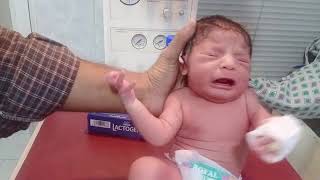 New born baby recovred well take oral feed iv canol aremoved baby is admit under care of   granting💞