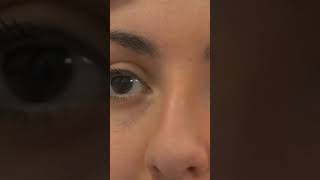 Unintentional asmr eye examination