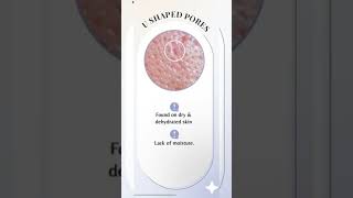 U Shaped Pores #skintype #skincare #routines