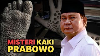 Kerap dihina Pincang, inilah kisah kaki Prabowo sebenarnya