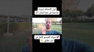 اول اكتشاف لدودة صاحية في مخ انسان 🪱 #دواك_موجود #دكتور_محمد_خالد #reels #shorts