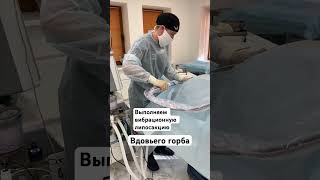 Липосакция вдовьего горба #shorts