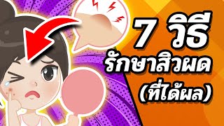 📌😍 7 วิธีรักษาสิวผด (ที่ได้ผล) + สาเหตุของสิวผด (เผยผิวเนียใส)