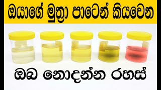 ඔයාගේ මුත්‍රා පාටෙන් කියන නොදන්න රහස්   What Urine Color Indicates About Your Body