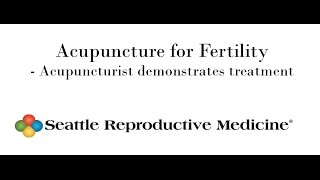 Acupuncture for Fertility - Acupuncturist demonstrates treatment