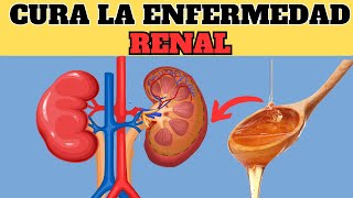 Nunca MÁS UN  paciente RENAL volverá a perder un riñón, ATENTO A ESTE VIDEO