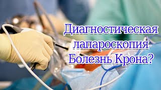 Диагностическая лапароскопия  Болезнь Крона #БолезньКрона #крона  #лапароскопия