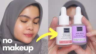 Scarlett Serum Update 3 Bulan di Jerawat + Bekas