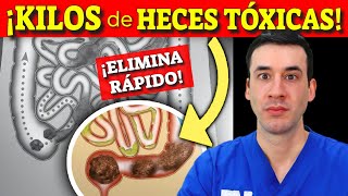 ¡ALIVIA el ESTREÑIMIENTO RÁPIDO y EXPULSA las HECES TÓXICAS! (sin remedios)