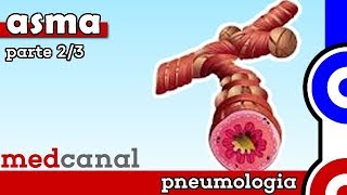 Asma II (Tratamento de manutenção) | PNEUMOLOGIA