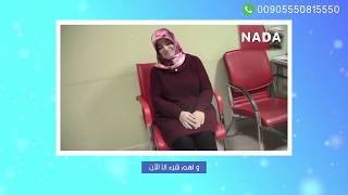 السيدة سيفجي من تركيا | عمليات تكميم و قص المعدة في تركيا | NADA Center