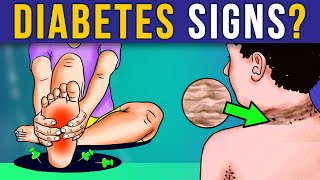 Crucial Alerts: 7 Diabetic Symptoms You MUST Recognize ASAP