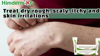 Himderm K6  Cream || Best Anti Fungal Cream || eczema Psoriasis RingWorm