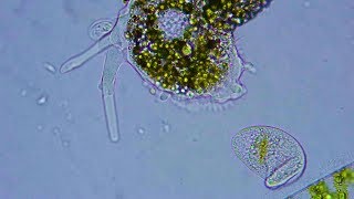 Giant Amoeba and Ciliates