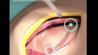 Anterior approach shoulder.. Animation for Study purpose. #hospital #doctor #patient#mbbsstudent