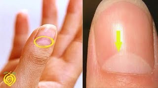 Do you have the half moon shape on your nails!  this is what it really means!