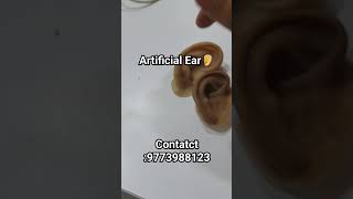 Artificial Ear | नकली कान #artificialear #prosthesis #siliconear #artificiallimbs #nakliungli #ear