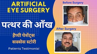 Artificial eye surgery पत्थर की आँख