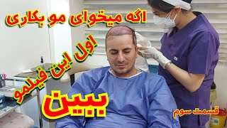 کاشت مو در ایران قسمت سوم  😱 ازهمه چی فیلم گرفتم 😱جواب تمام سوالهای شما در مورد کاشت مو اینجاست 🤔