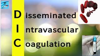 DIC - DISSEMINATED INTRAVASCULAR COAGULATION #DIC #Coagulationdisorder #pathology #physiology