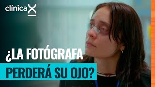 Fotógrafa herida en una manifestación | Clínica X