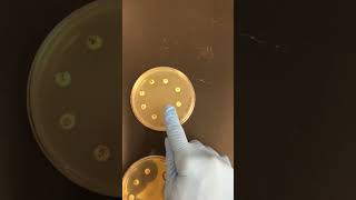 Antibiotic disk susceptibility test results