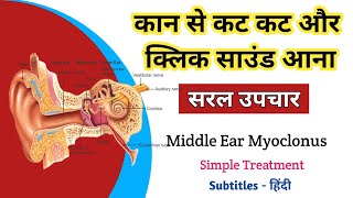 कान से कट कट की आवाज़ आना | Middle Ear Myoclonus | Ear disease | Hearing loss | SNHL | Tinnitus |