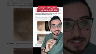 ممنوع نحقن فيلر مش Hyluronic acid filler!   #shorts t