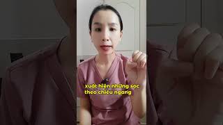 Bí mật nhìn màu sắc móng tay chẩn đoán cơ thể thiếu chất gì. Dr Ngọc Yến #songkhoe #thieumau