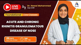 90 Days University in ENT on Acute & Chronic rhinitis Granulomatous disease of nose by Dr Nawal