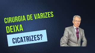 Cirurgia de varizes deixa cicatrizes?