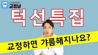 치아교정 얼굴변화! 턱이 갸름해질 수 있을까? 실제 전후를 비교해 봅시다