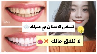 لا تنفق مالك❌👛 | | تبييض الاسنان في منزلك و كل المواد متوفرة⁦☁️⁩🌿