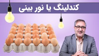 کندلینگ یا نوربینی