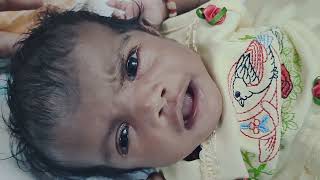 Medical Education Video: Neonatology: Right Sided LMN Facial Palsy in a baby with Microtia