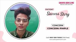 Best Pimple Treatment Testimonials | Pimple Treatment Review | Sakhiya Skin Clinic Review