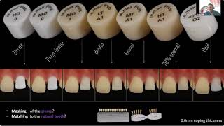 Ingot selection for single central cases