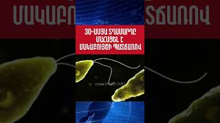 30-ամյա տղամարդը մահացել է մակաբույծի պատճառով