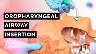 Oropharyngeal Airway Insertion | Guedel | OPA | ABCDE Emergency | OSCE Guide | UKMLA | CPSA | PLAB 2