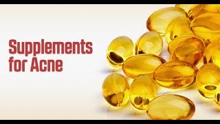 Supplements for Acne