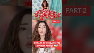 30 YIL BOYUNCA SÜREKLİ KOLA İÇEN KADIN |PART-2 😱😱 #shorts #tiktok #nurözkurt