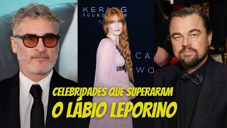 Você Sabia que Essas Celebridades Têm Lábio Leporino?