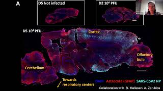 [Rejane Rua] Meningeal macrophages protect against viral neuroinfection