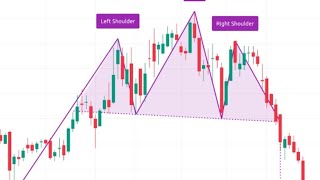 Head & Shoulders Chart Pattern