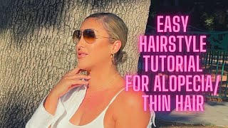 Easy Hairstyle for Thinning Hair/Alopecia