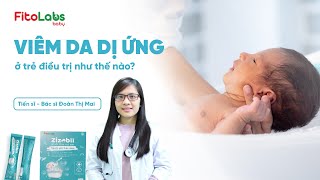 Biện pháp điều trị trẻ bị viêm da dị ứng